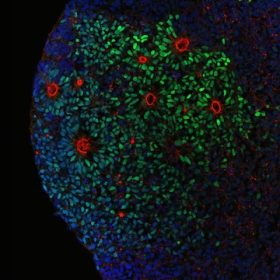 Neurodevelopment Cluster