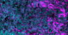 Neurodevelopment Cluster