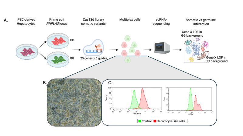 Interaction between germline and somatic variants in steatotic liver disease